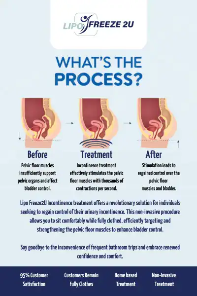 Diagram of how incontinence treatment Grimsby works.