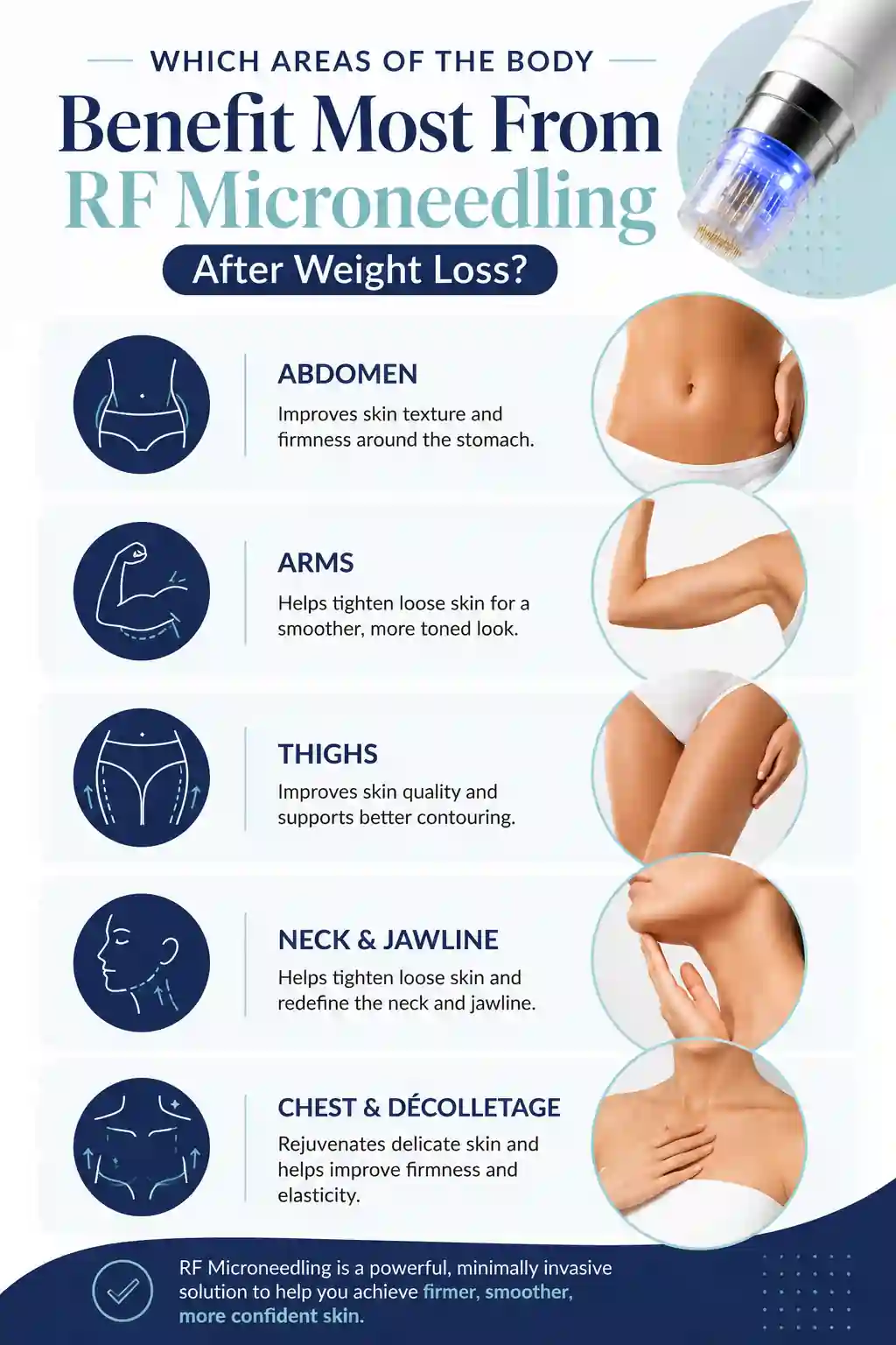 Which Areas of the Body Benefit Most From RF Microneedling After Weight Loss Grimsby